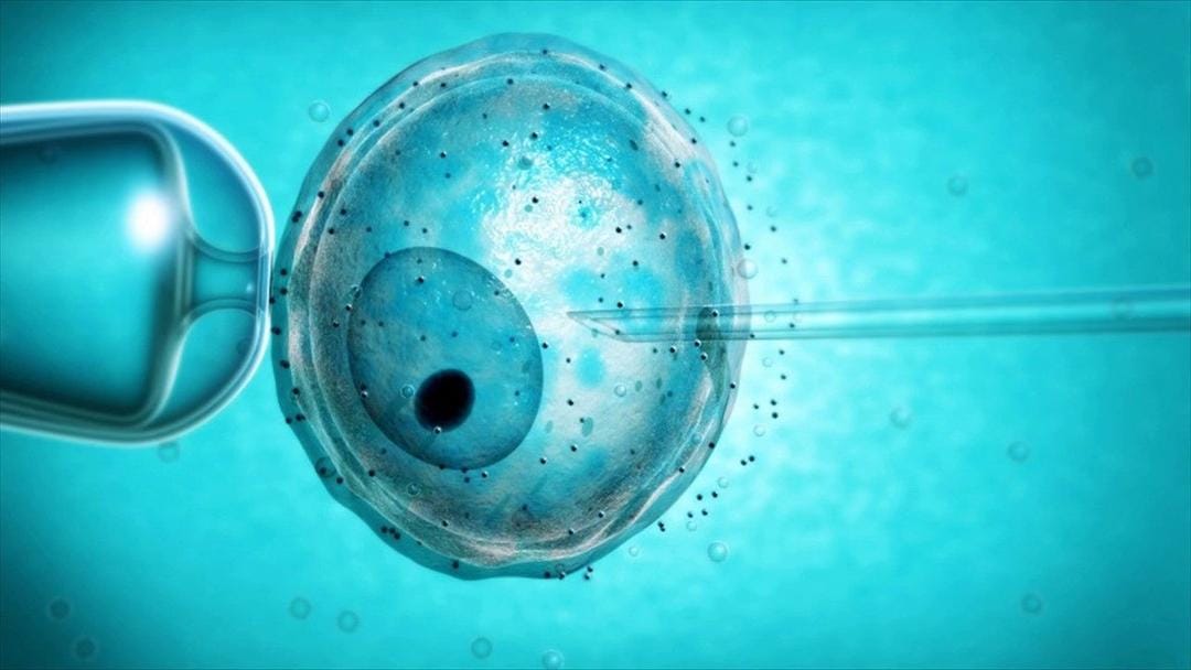 Inseminasi buatan bisa tentukan jenis kelamin bayi