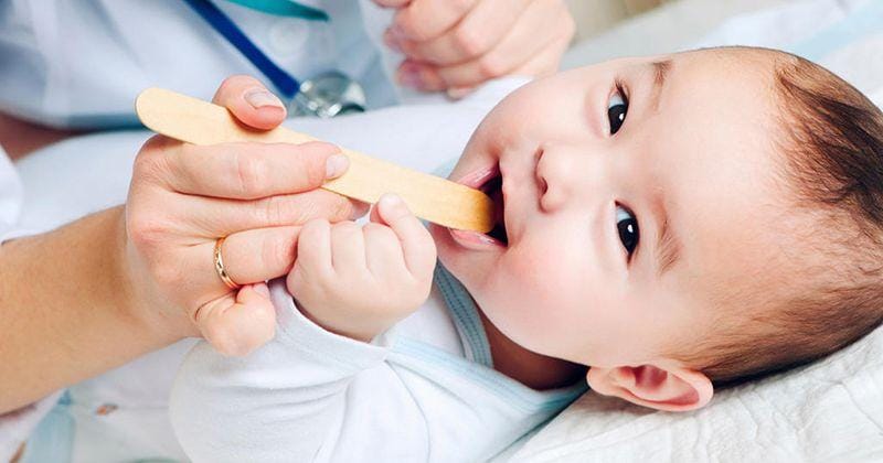 Memeriksa mulut bayi