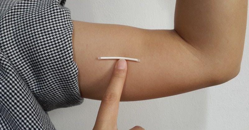 KB implan sering jadi solusi pasangan suami istri untuk membatasi jumlah anak.